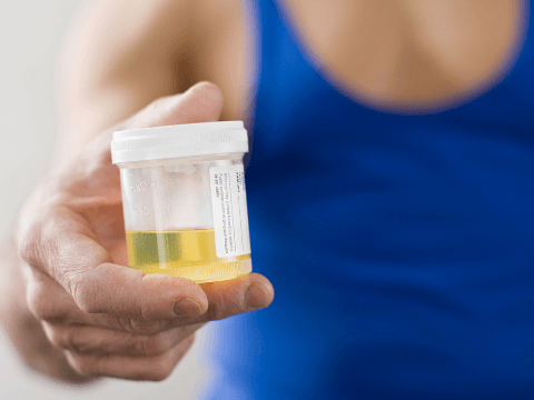 urine drug test