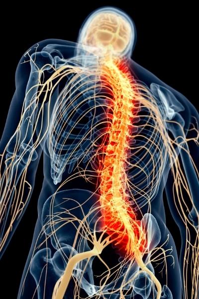 nerve pain